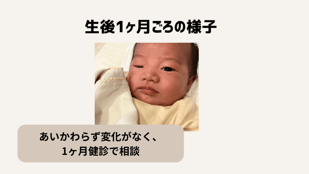 赤ちゃんの先天性眼瞼下垂と診断された話|生後1ヶ月ごろの様子