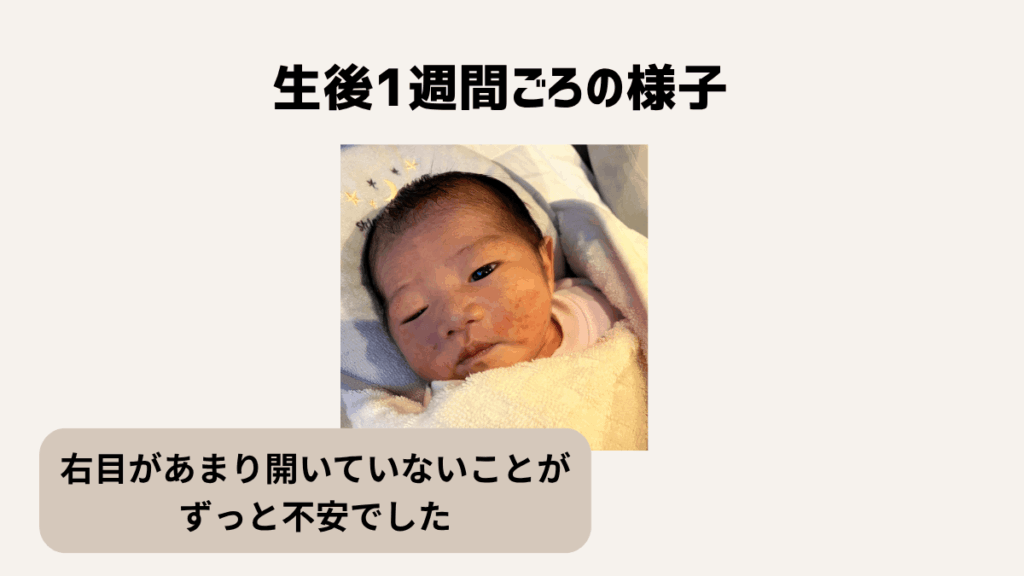 赤ちゃんの先天性眼瞼下垂と診断された話|生後1週間ごろの様子